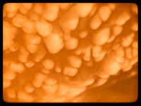 Mammatus Cloud Formation